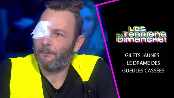 Gilet Jaune, Jean-Marc victime d'une flash-ball - Les Terriens du Dimanche