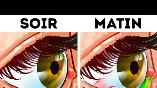 Pourquoi Tes Yeux Font-ils des Croûtes Quand Tu Dors