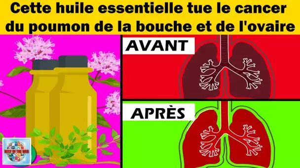 Cette huile essentielle soigne le cancer du poumon de la bouche et de l’ovaire