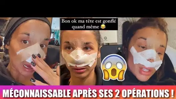 ISABEAU MÉCONNAISSABLE APRÈS SES 2 OPÉRATIONS… 😱 ELLE S’EXPRIME APRÈS SON ABSENCE !!