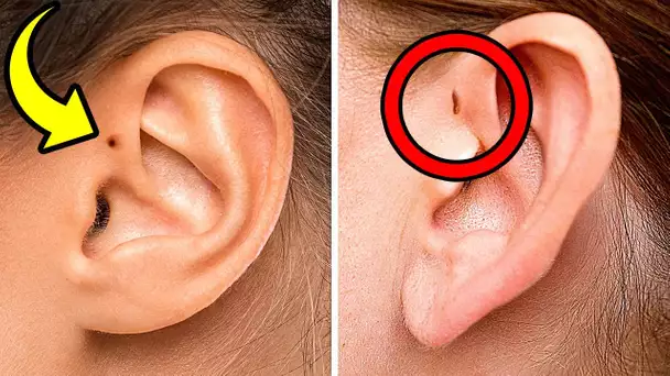 Tes Oreilles Peuvent Révéler à Quel Point tu es Spécial + 10 Caractéristiques Corporelles Uniques