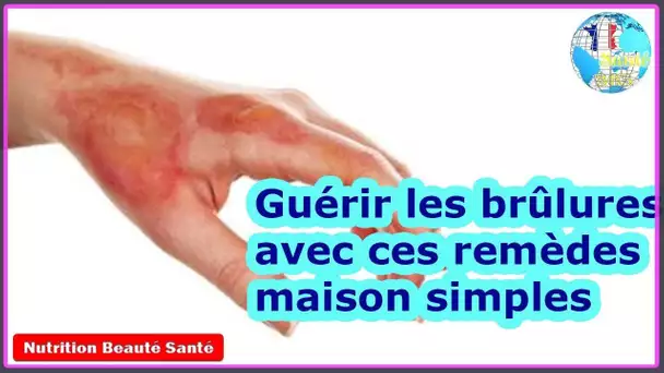 Guérir les brûlures avec ces remèdes maison simples|Nutrition Beauté Santé