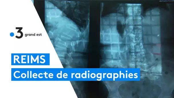 Reims : une campagne de collecte et recyclage des anciennes radiographies pour les malades du cancer