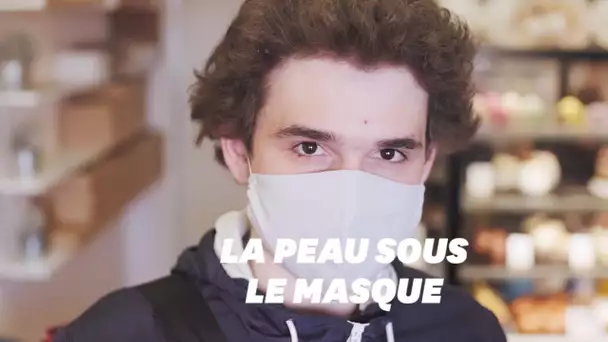 Le masque entraîne des irritations, voici ce qu’il faut faire pour préserver sa peau