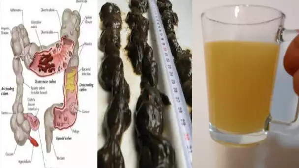 Une boisson naturelle pour vider votre colon et dégonfler le ventre