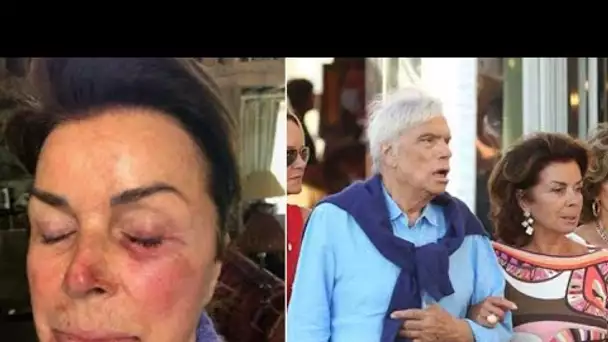 Bernard Tapie et son épouse très violentés, les détails glaçants de la terrible agression dévoilés