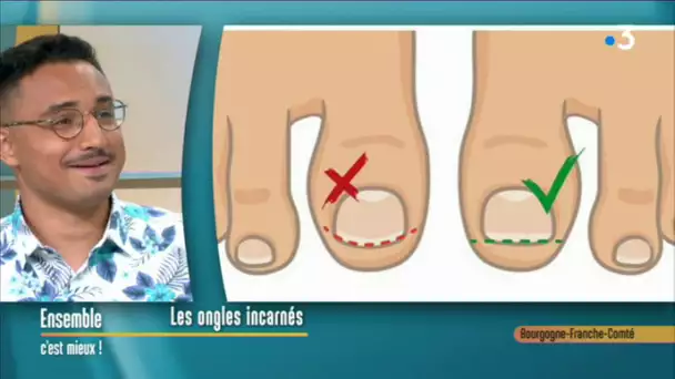 L'ongle incarné : un p'tit bobo qui peut faire très mal !