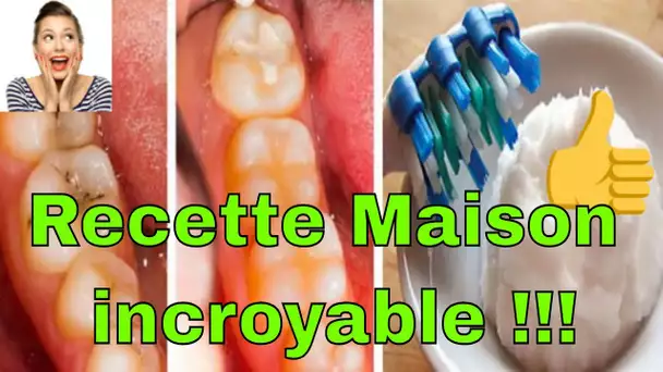 Voici comment vous pouvez traiter naturellement une carie dentaire. Recette incroyable !!!