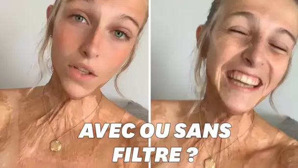 La blogueuse Julie Bourges incite ses abonnés à s’accepter sans filtre sur Instagram