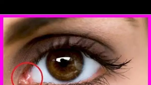 Voici ce que signifie ce petit angle rose au coin de votre œil