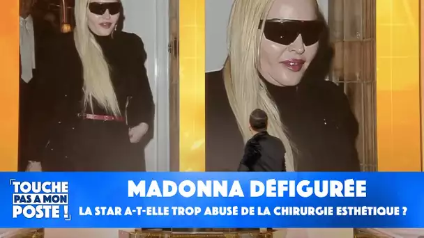 Madonna défigurée : la star a-t-elle trop abusé de la chirurgie esthétique ?