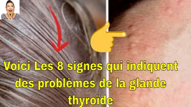 Voici 8 symptômes des problèmes de thyroïde que vous ne devez ignorer absolument