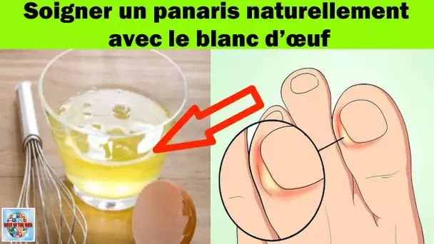 Comment soigner un panaris naturellement avec le blanc d’œuf