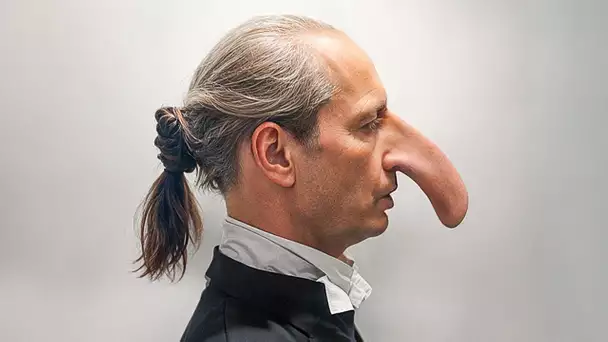 Comment cet Homme a Vécu Avec un nez Plus Gros que Votre Avant-bras