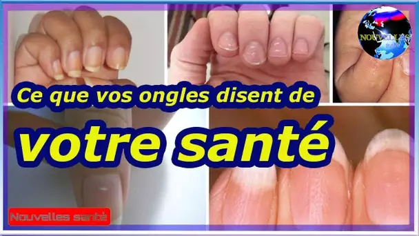 Ce que vos ongles disent de votre santé|Nouvelles24h