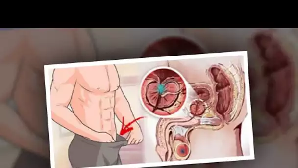 12 symptômes avant-coureurs du cancer de la prostate que tous les hommes doivent connaitre