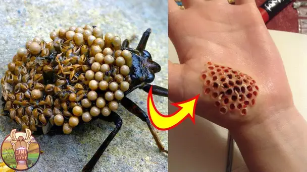 Faites ATTENTION Aux Piqures de Ces Insectes !