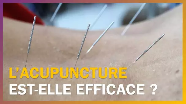 L&#039;acupuncture est-elle efficace ?