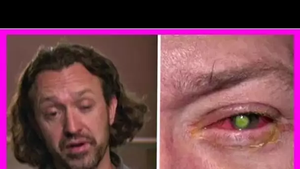 Cet homme a perdu un oeil à cause d’une lentille de contact lavée avec Ceci … Et ça pourrait arrive