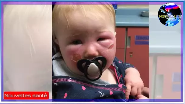Ce bébé a eu des brûlures sévères – maintenant sa mère prévient contre ce produit !