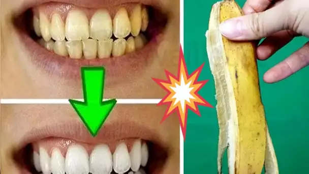 Seulement 1 Minute Gets You White Teeth Like Pearls!