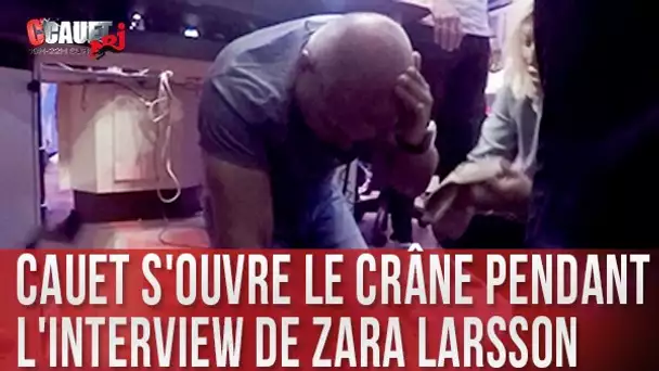 Cauet s&#039;ouvre le crâne pendant l&#039;interview de Zara Larsson - C’Cauet sur NRJ
