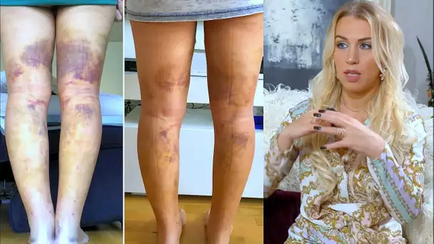La Youtubeuse EmmyMakeUpPro découvre sa maladie grâce à une abonnée ! Témoignage