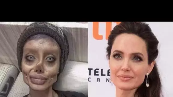 Elle fait plus de 50 opérations pour ressembler à Angelina Jolie : effrayant