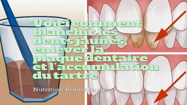 Voici une recette au bicarbonat de soude pour blanchir les dents jaunes, enlever la plaque dentaire