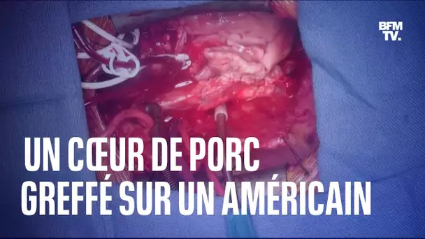 Aux États-Unis, un cœur de porc génétiquement modifié a été greffé avec succès sur un Américain