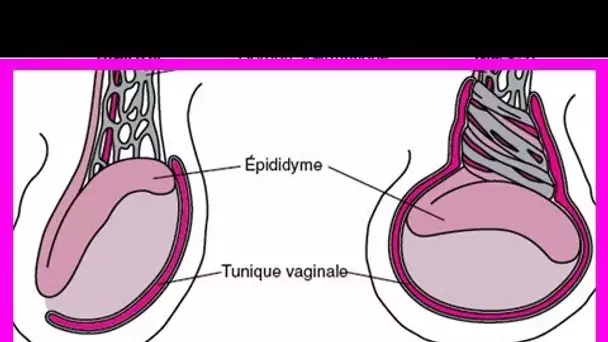 200 millions d’euro en dédommagement pour une torsion testiculaire… En être conscient peut faire un