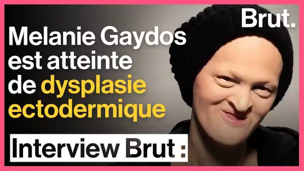 Interview Brut : Melanie Gaydos