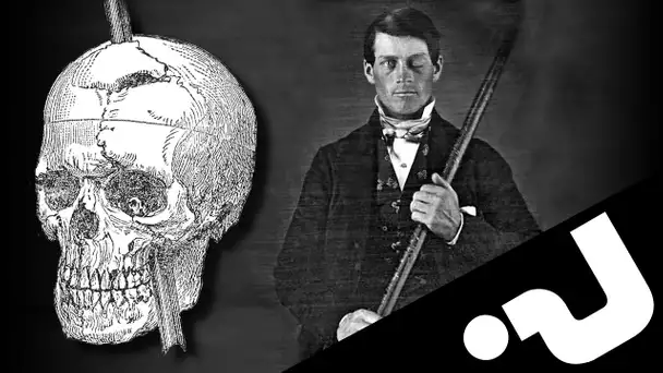 🪐L'incroyable histoire de Phineas Gage