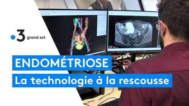 Endométriose : la réalité virtuelle fait avancer la médecine