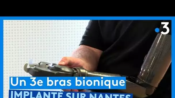 Bras bionique : une troisième intervention réalisée à Nantes