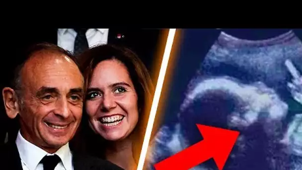 Fille ou Garçon ?! L'échographie du bébé d'Eric Zemmour & Sarah Knafo ! Le Zap du jour ! 30/11/2021