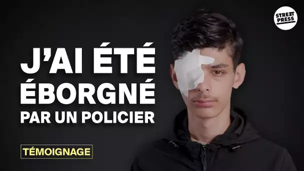 Jalil, 15 ans, éborgné par la police pendant les révoltes à  Chilly-Mazarin