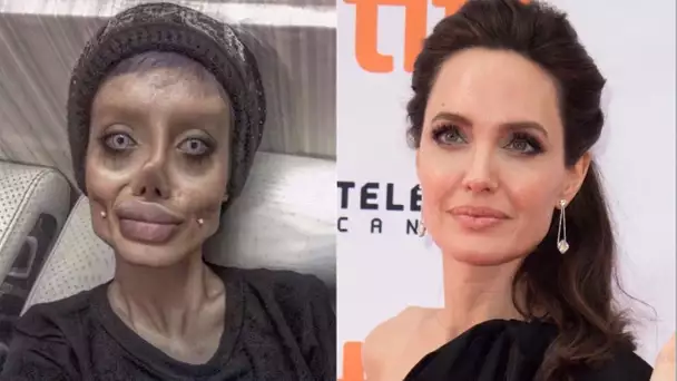 Cette femme a subi plus de 50 opérations pour ressembler à Angelina Jolie