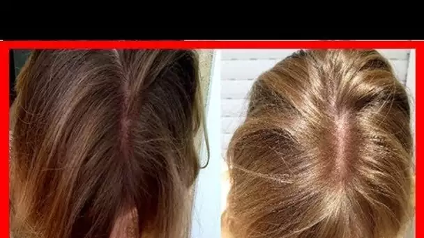 COMMENT ÉCLAIRCIR SES CHEVEUX NATURELLEMENT?