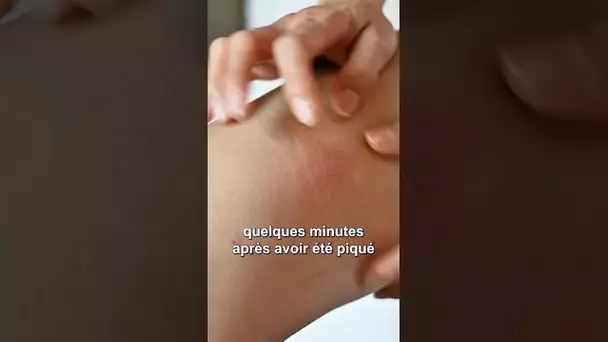 Santé : comment reconnaître une piqûre de moustique tigre ?