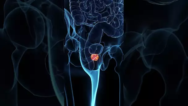 Qu’est-ce que l’hypertrophie de la prostate ?