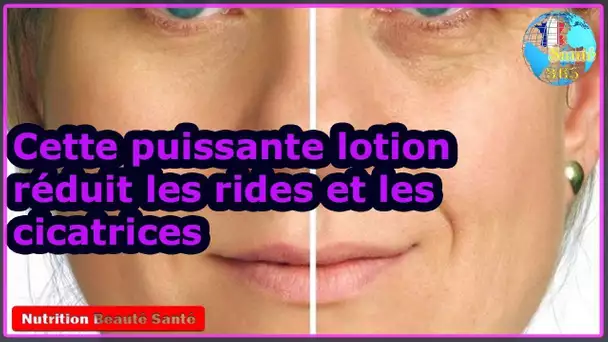 Cette puissante lotion réduit les rides et les cicatrices|Nutrition Beauté Santé