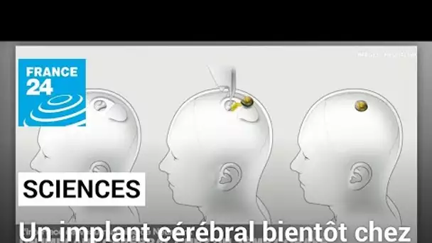 Neuralink : un implant cérébral bientôt chez un second cobaye • FRANCE 24