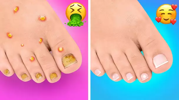 ASTUCES GÉNIALES POUR QUE TES PIEDS SOIENT BEAUX ET EN BONNE SANTÉ