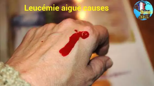 Leucémie aiguë causes