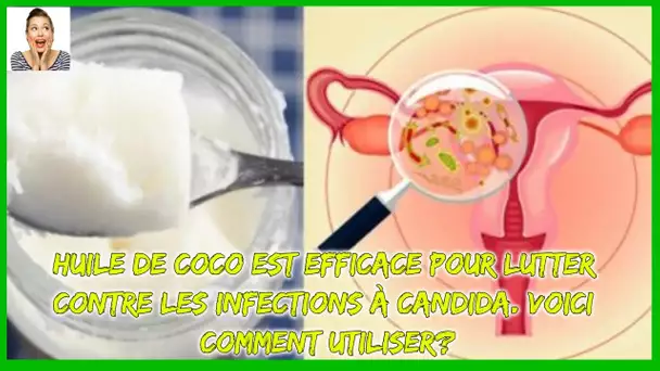 Les microbiologistes ont découvert que l'huile de coco est efficace pour lutter contre Candida