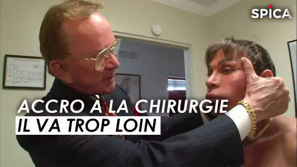 Accro à la chirurgie, il va trop loin