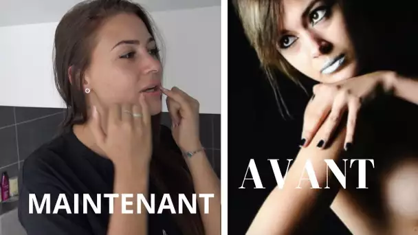 Alix transformée par la chirurgie-esthétique ? Elle assume tout !