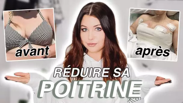 RÉDUIRE SES SEINS : Expérience, Prix, Raisons...