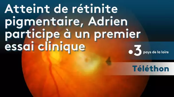 Téléthon : atteint de rétinite pigmentaire, Adrien participe à un premier essai clinique